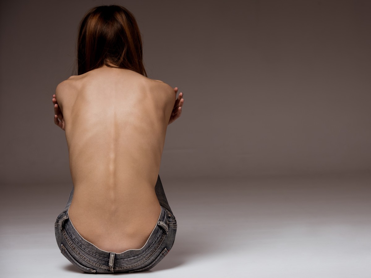 Más datos para entender la anorexia