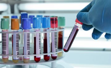Presentan prometedora prueba de sangre para predecir el alzhéimer