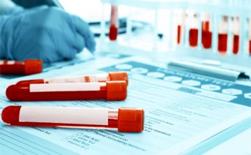 Clave hacerse la prueba que detecta la hepatitis C