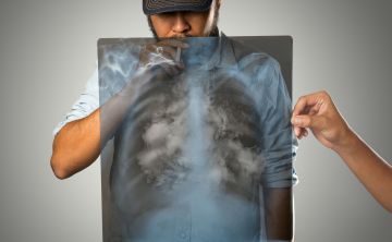 Evoluciona el tratamiento de cáncer de pulmón